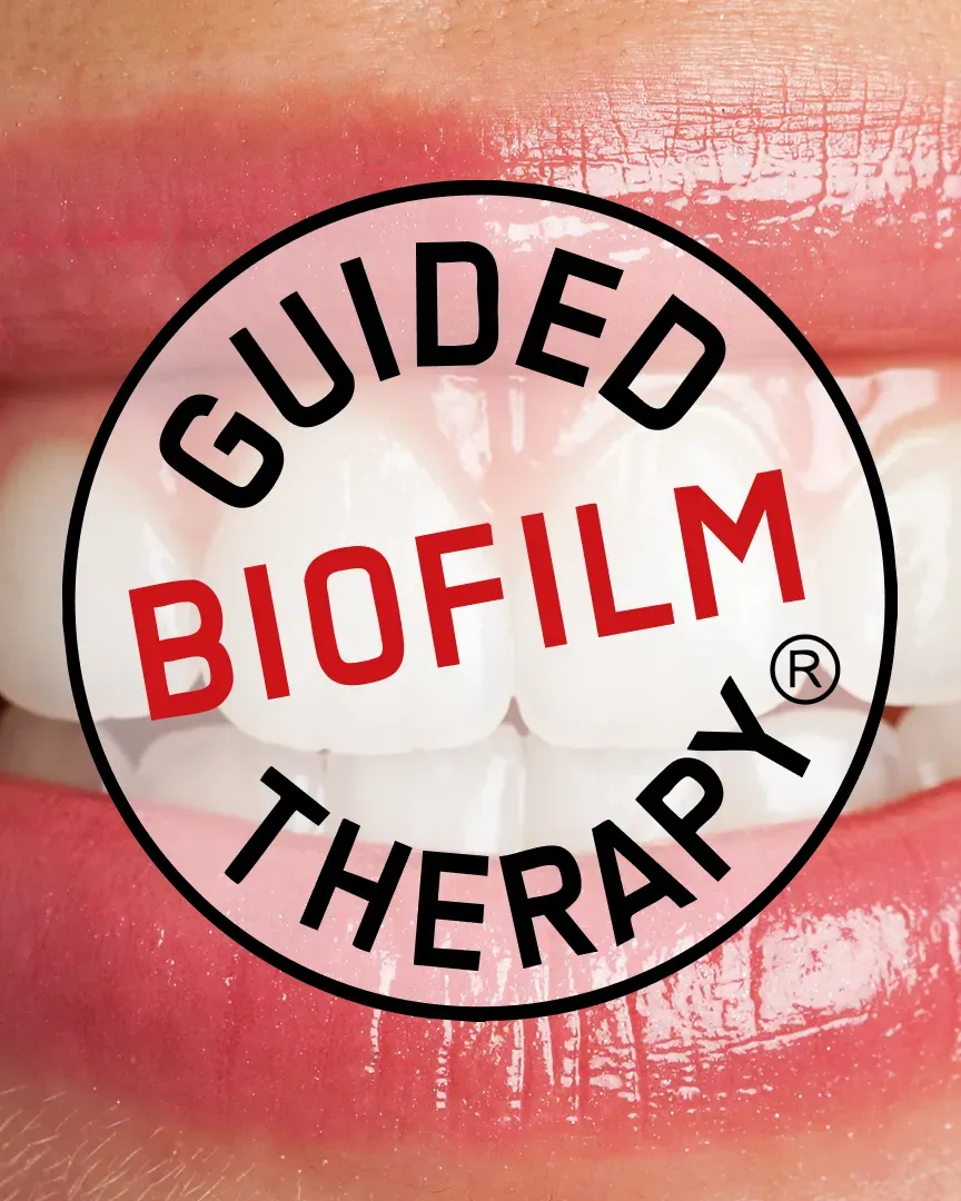Zâmbet cu logo-ul Guided Biofilm Therapy (GBT)